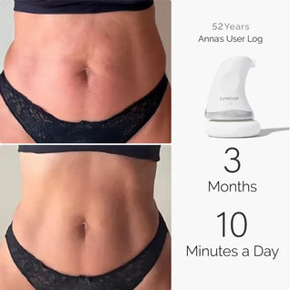 LumiSculpt SculptCore™ — Ultrasonic Body Care Massager