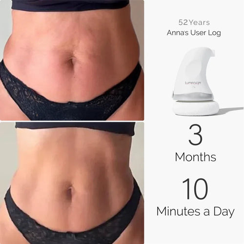 LumiSculpt SculptCore™ — Ultrasonic Body Care Massager