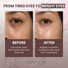 LumiSculpt EyeGlow™ Mask — Collagen Under-Eye Recovery Mask - Lumi Sculpt