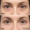 LumiSculpt Patches™ — Collagen Under-Eye Hydrogel Treatment - Lumi Sculpt