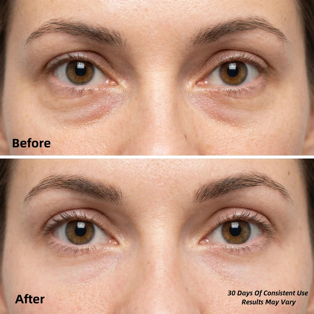 LumiSculpt Patches™ — Collagen Under-Eye Hydrogel Treatment - Lumi Sculpt