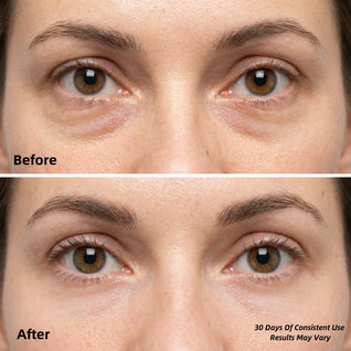 LumiSculpt Patches™ — Collagen Under-Eye Hydrogel Treatment