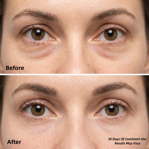 LumiSculpt Patches™ — Collagen Under-Eye Hydrogel Treatment