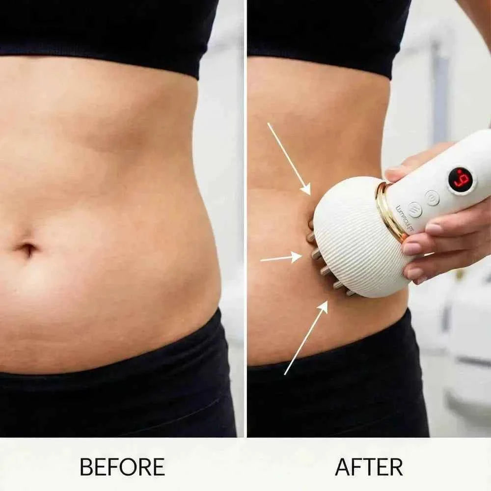 LumiSculpt LymphPro™