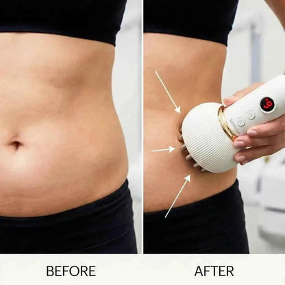 LumiSculpt LymphPro™