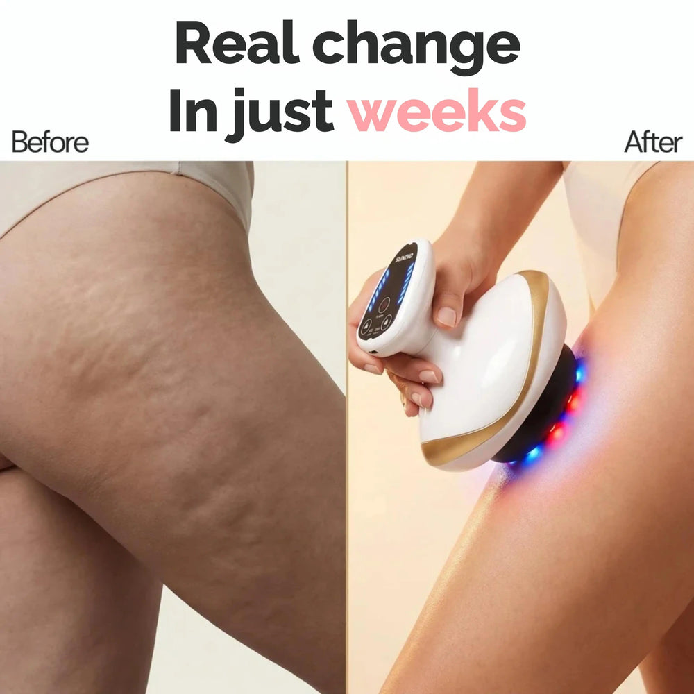 LumiSculpt GlowWand cordless rechargeable body contouring device